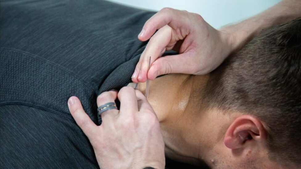 The Science Behind Acupuncture and Dry Needling: How They Work to Keep You Moving 
