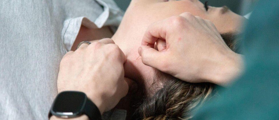 Dry Needling for Muscle Tightness and Trigger Points: What You Need to Know 