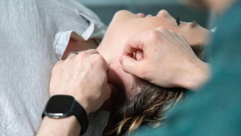 Dry Needling for Muscle Tightness and Trigger Points: What You Need to Know 