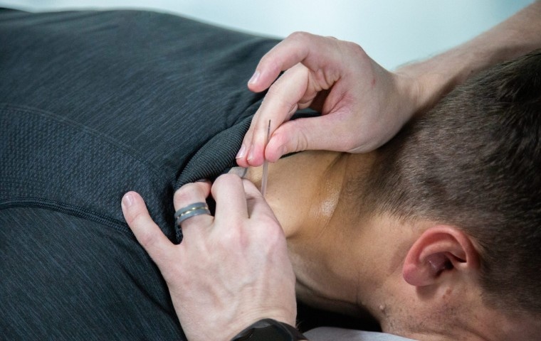 Dry needling technique applied to the neck to relieve muscle tension at MYo Lab Health & Wellness in Calgary.