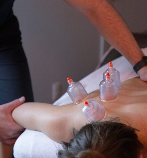 Back cupping MYo Lab Health & Wellness in Calgary, Alberta