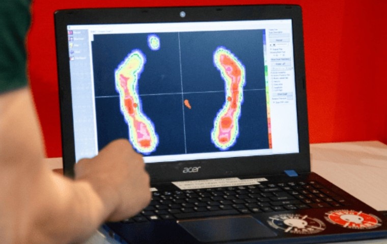 Plantar pressure mapping displayed on a computer during a custom orthotics assessment at MYo Lab Health & Wellness.